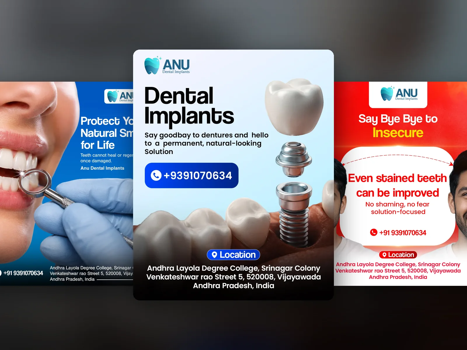 ANU Dental case study — ANU DENTAL · FEED + STORIES